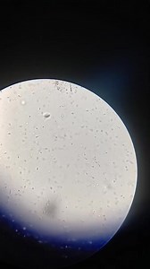 43K views · 640 reactions | Semen analysis ❤️❤️. | Lab life | Facebook