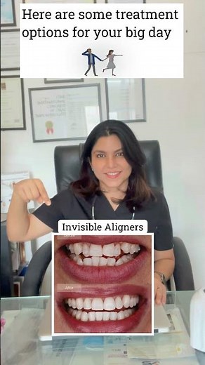 Celebrity Smile Makeover Before & After | Teeth Whitening & Veneers | Dr. Aratee Gupta