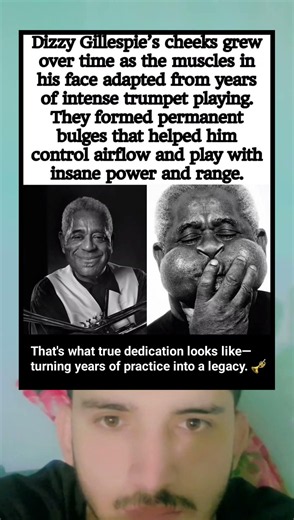 Why Dizzy Gillespie's Cheeks Became So Famous 😳🎺