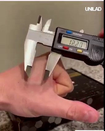 This guy has got a futuristic chip installed in his hand and it can do all sorts of things 😲 | UNILAD