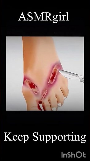 Ultimate Foot Cleaning ASMR ✨ Soothing Scrubbing & Water Sounds for Deep Relaxation