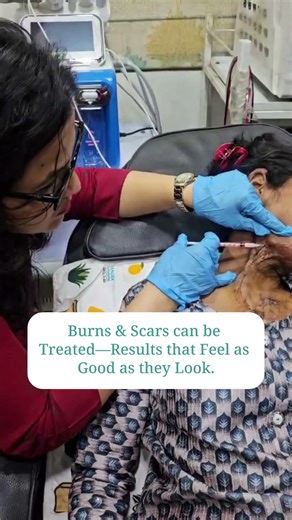 Burns and Scars Can Be Treated | Results That Feel As Good As They Look | Dr. Neha Rathi