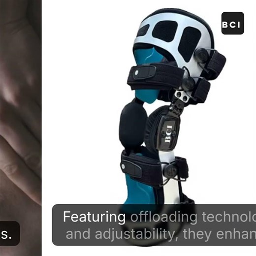 Choosing the Right Knee Brace for Osteoarthritis