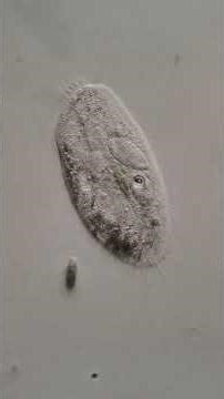 microscopy video - ciliates hypotrichs