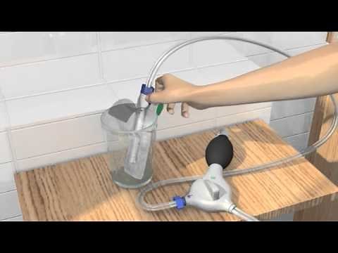 Système Peristeen - Mode d'emploi