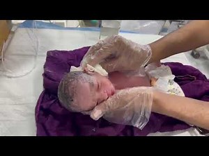 25 Weeks Premature Baby | Early Cry & Cleaning Care | NICU Journey 👶💖 Emergency Care