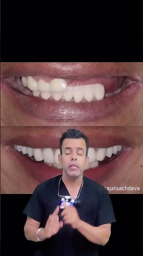 Mastering Shade Selection in Dentistry | Secrets to Perfect Shade Selection in Cosmetic Dentistry