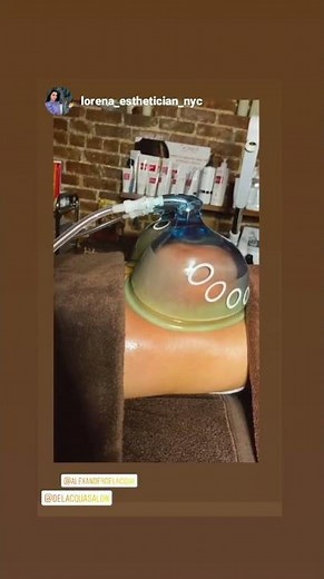 Butt Lift Vacuum therapy