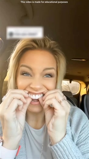 Amazing Facts About False Teeth You Didn't Know