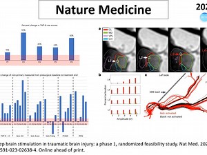 Nature Medicine—丘脑深部脑刺激可改善TBI相关认知功能损害
