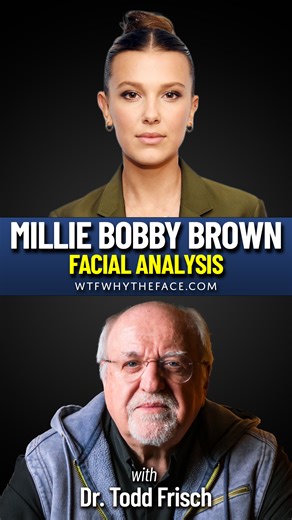 Millie Bobby Brown’s face tells a story far deeper than fame and red carpets. 🎬✨ | WTF? Why the Face
