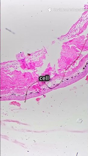 Cell Membrane vs Cell Wall