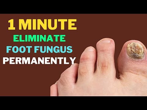 This “1-Minute Sock Trick” Smothers Foot Fungus For Good