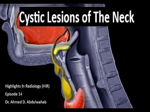 Cystic Lesions of the Neck, Highlights in Radiology, Episode 14