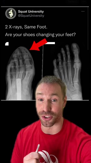 Understanding toe box. #shoes #shoeschallenge #shoecheck #barefoot #health