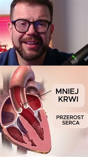 Różne choroby zastawki serca #kardiochirurgia #zwężeniazastawki #niedomykalnośćzastawki#aorta