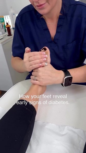 Recognize Early Diabetes Signs Through Your Feet