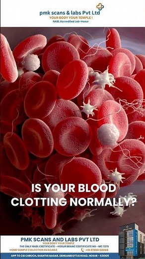 🩸 Coagulation Profile Test – Know Why Your Blood Clots!