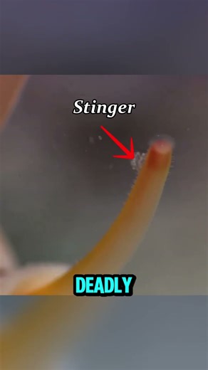 Beautiful but Deadly The Shell That Kills