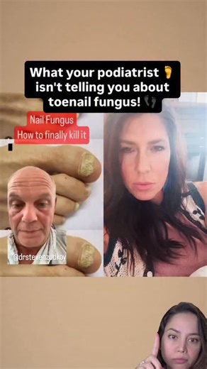 Danica on Instagram: "To truly stop stubborn toenail fungus, you have to break down internal biofilms. My personal favorite is Nattokinase (as mentioned) and Serrapeptase Biofilms act like a protective shield for fungus, bacteria, and parasites. If you don’t break that shield down, topical treatments and even cleanses often fall short. These proteolytic enzymes help dissolve biofilms, allowing the body to actually clear what’s been hiding underneath. That’s why many people feel dramatically bett