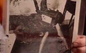 Spontaneous Human Combustion