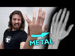 how i broke my hand...