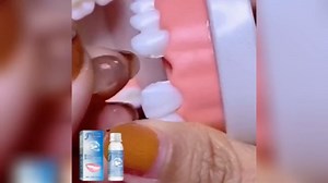 Tooth Repair Kit,Temporary Fake Teeth Replacement Kit Repair Missing or Broken Teeth and Make You Smile Confidently Again,DIY Heat Fit Beads