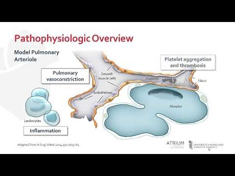 Pathophysiology of Pulmonary Arterial Hypertension
