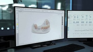 clip-3504630767-medical-system-digitally-inserting-dental-restorations-into