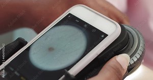 Dermatologist Examines A Skin. Professional Doctor The Dermatologist Research A Birthmark On The Phone Connected To Special Dermoscopy Tool, Before The Procedure Of Laser Removal Of A Birthmark