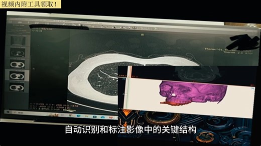 DICOM影像浏览器？dcm文件怎么转换jpg？看病软件？