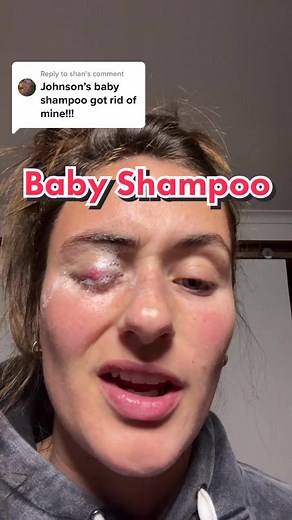 Effective Baby Shampoo for Eye Care: Tips & Recommendations