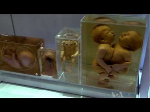 Medical Museum : anatomical collections of bones : preserved human organs