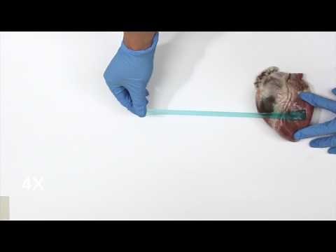 Slug slime inspires a new type of surgical glue | Science News