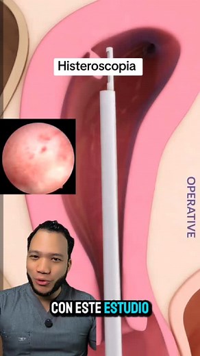 1.4K reactions · 41 comments | ¿Sabías que un procedimiento sencillo...