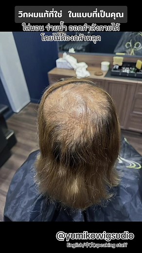 วิกผมแท้ที่ใช่: บริการออกแบบและผลิตติดกาว