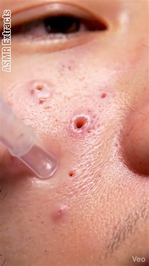 ASMR Extracts | Silent Extraction