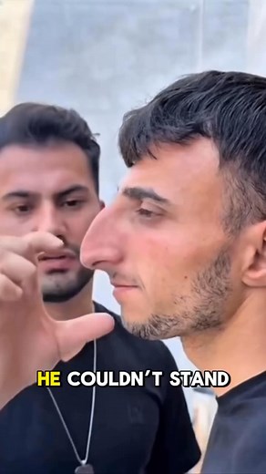 70K views · 150 reactions | He Hated His Nose for 24 Years—What He Did About It Changed Everything... Results in Comments!  | USA 100K | Facebook