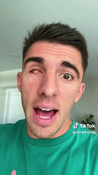 What Do You See With a Missing Eye? Explaining Vision After Eye Removal