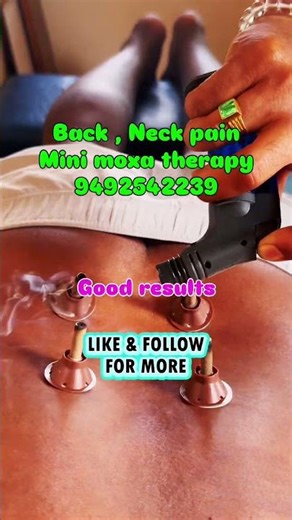 Back pain and neck pain treatment for Mini moxa therapy