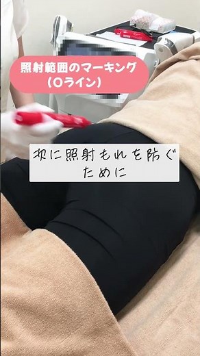 【 VIO脱毛手順 】施術の様子を公開（メディオスターモノリス） #shorts