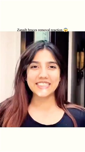Zanaib braces removal reaction 😱|#sistrology #ytshorts #viralvideo #trending