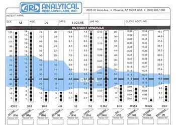 Hair Tissue Mineral Analysis Test (HTMA) | Heavy Metal Test for Lead, Mercury, Cadmium, Arsenic, Aluminum