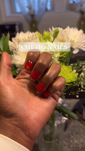 Surviving Chemo: My Nail Journey Through Chemotherapy