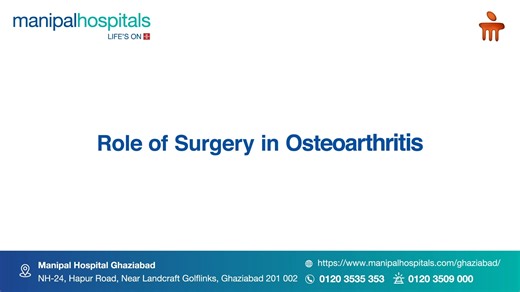 289K views · 121 reactions | When does osteoarthritis require surgery? In this video, Dr. Ashutosh Jha, Consultant – Orthopaedics at Manipal Hospital Ghaziabad, explains the role of surgical intervention in managing advanced osteoarthritis, when conservative treatments no longer provide relief. Understand your options and take informed steps toward better joint health. #ManipalHospitalGhaziabad #YourManipal #LifesOn | Manipal Hospitals | Facebook