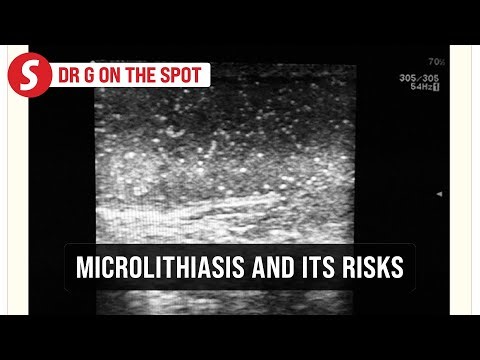 EP298: Testicular microcalcification and risk of cancer | PUTTING DR G ON THE SPOT
