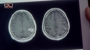 867K views · 12K reactions | On the left, see an MRI scan with a...