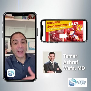 📢EXCITING NEWS📢 Todd Ponsky, MD, and the Stay Current: Pediatric Surgery app are excited to introduce Dr. Tamer Ashraf Pediatric Surgeon from Mansoura University Children's Hospital, Egypt. Dr. Ashraf has created an incredible library of open pediatric surgery technique videos that will now be available on the StayCurrent in Pediatric surgery app. This week, we are releasing the “Duodeno-duodenostomy for Duodenal Atresia”. See the full video here on the Stay Current: Pediatric Surgery app: htt