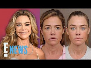 Denise Richards Reveals "Shocking" Facelift Before & After | E! News
