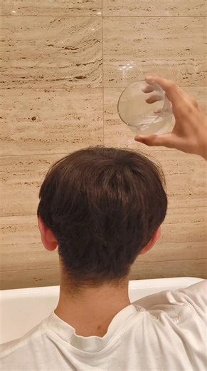 Hair transplant: $5,000 RIZEN™: $19.99 Looking confident again: priceless. | Rizen